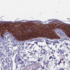 Anti-CLCA2 antibody produced in rabbit 
