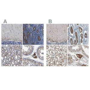Anti-CLCC1 antibody produced in rabbit 