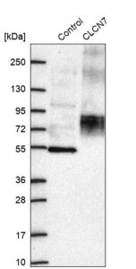 Anti-CLCN7 antibody produced in rabbit 