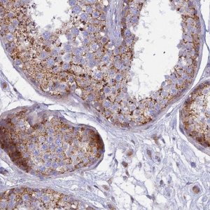 Anti-CLCN7 antibody produced in rabbit 