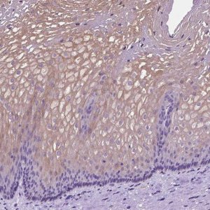 Anti-CLDN17 antibody produced in rabbit 