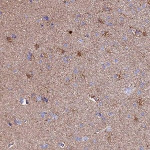 Anti-CLEC2L antibody produced in rabbit 