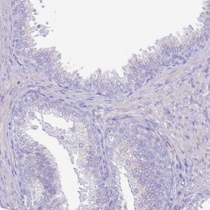 Anti-CLEC4M antibody produced in rabbit 
