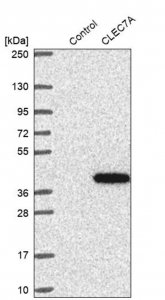 Anti-CLEC7A antibody produced in rabbit 