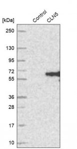 Anti-CLN5 antibody produced in rabbit 