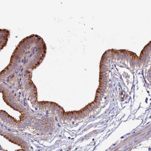 Anti-CLN5 antibody produced in rabbit 