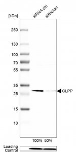 Anti-CLPP antibody produced in rabbit 