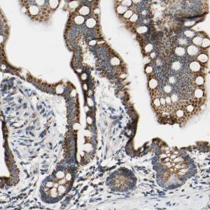 Anti-CLPP antibody produced in rabbit 