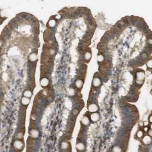 Anti-CLRN3 antibody produced in rabbit HPA014482-100UL