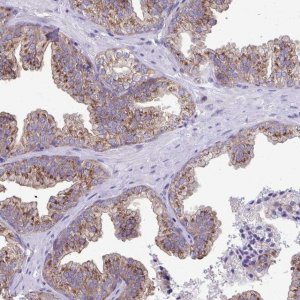 Anti-CLTA antibody produced in rabbit 