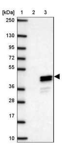 Anti-CLVS1 antibody produced in rabbit HPA053869-100UL