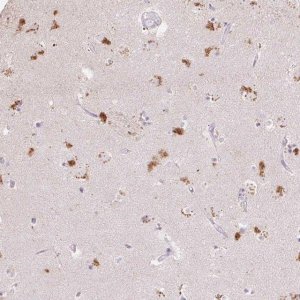 Anti-CLVS1 antibody produced in rabbit HPA053869-100UL