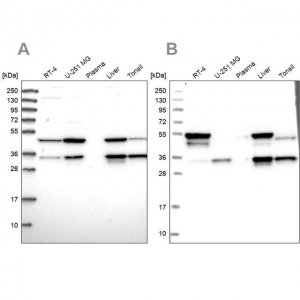 Anti-CLYBL antibody produced in rabbit 