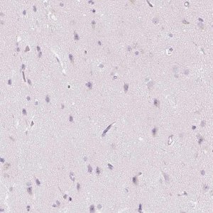 Anti-CMA1 antibody produced in rabbit 