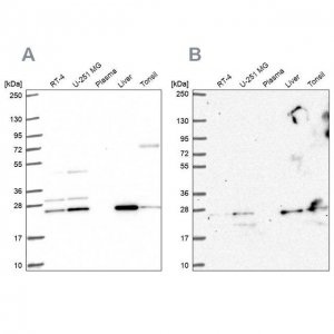 Anti-CMPK1 antibody produced in rabbit HPA053730-100UL