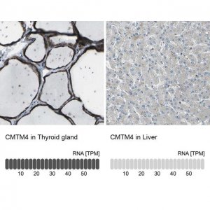 Anti-CMTM4 antibody produced in rabbit 
