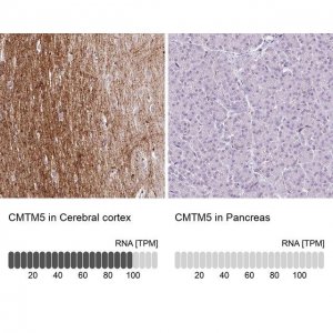 Anti-CMTM5 antibody produced in rabbit 