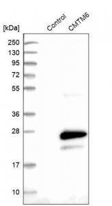 Anti-CMTM6 antibody produced in rabbit 