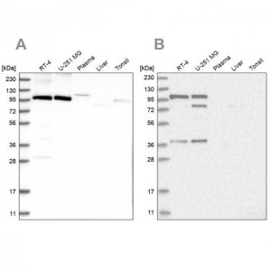 Anti-CMTR1 antibody produced in rabbit 
