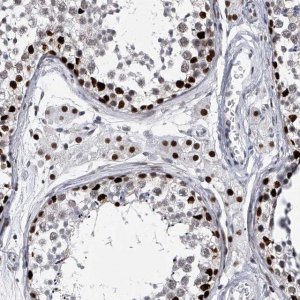 Anti-CMTR1 antibody produced in rabbit HPA029954-100UL