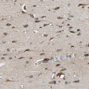 Anti-CNDP1 antibody produced in rabbit 