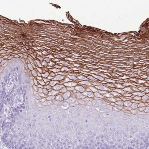 Anti-CNFN antibody produced in rabbit 