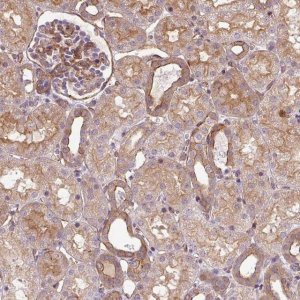 Anti-CNN3 antibody produced in rabbit 