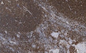 Anti-Cofilin-1 Antibody, clone 1C18 ZooMAb Rabbit Monoclonal 