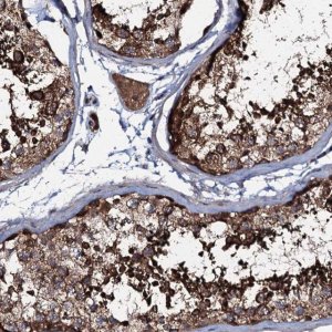 Anti-COG6 antibody produced in rabbit HPA040441-100UL