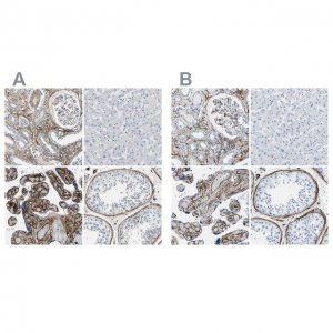 Anti-COL15A1 antibody produced in rabbit 