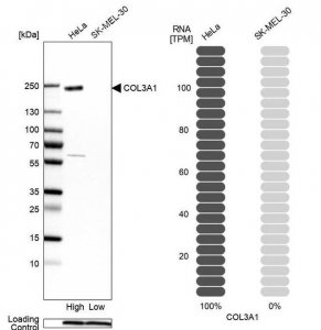 Anti-COL3A1 antibody produced in rabbit HPA007583-100UL