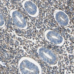 Anti-COL3A1 antibody produced in rabbit HPA007583-100UL