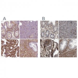 Anti-COL6A2 antibody produced in rabbit 