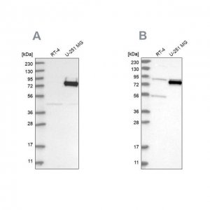 Anti-COLGALT2 antibody produced in rabbit HPA031750-100UL