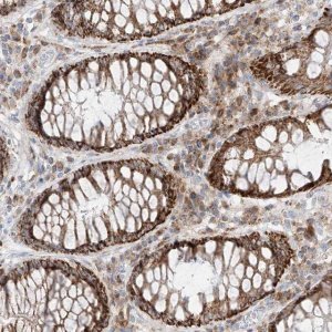 Anti-COLGALT2 antibody produced in rabbit HPA031750-100UL