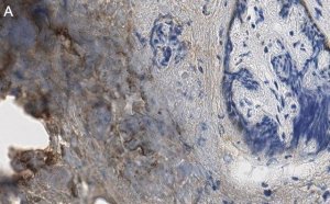 Anti-Collagen Type III Antibody, clone 3N18 ZooMAb Rabbit Monoclonal 