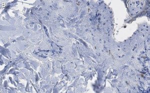 Anti-Collagen Type III Antibody, clone 3N18 ZooMAb Rabbit Monoclonal 