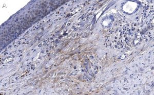 Anti-Collagen X 1 Antibody, clone 1O4 ZooMAb Rabbit Monoclonal 
