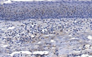 Anti-Collagen X 1 Antibody, clone 1O4 ZooMAb Rabbit Monoclonal 