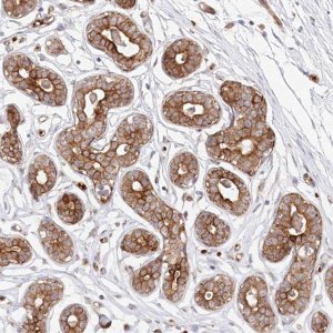 Anti-COMMD3 antibody produced in rabbit 