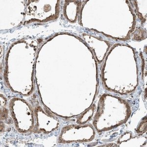 Anti-COMMD8 antibody produced in rabbit 