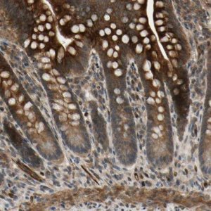 Anti-COMMD9 antibody produced in rabbit 