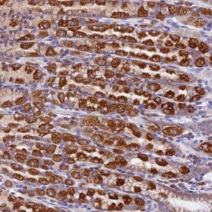 Anti-COMTD1 antibody produced in rabbit 