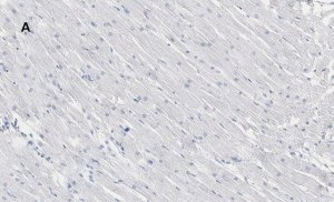 Anti-Connexin 43 Antibody, clone 5H23, ZooMAb Rabbit Monoclonal 