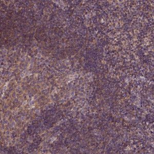 Anti-CPNE1 antibody produced in rabbit HPA072634-100UL