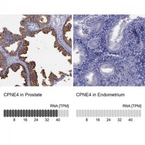 Anti-CPNE4 