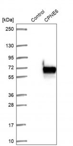 Anti-CPNE6 antibody produced in rabbit HPA031636-100UL