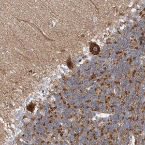 Anti-CPNE6 antibody produced in rabbit HPA031636-100UL