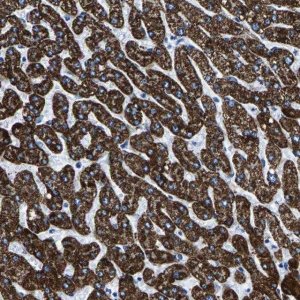 Anti-CPS1 antibody produced in rabbit 