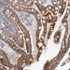 Anti-CPT2 antibody produced in rabbit 